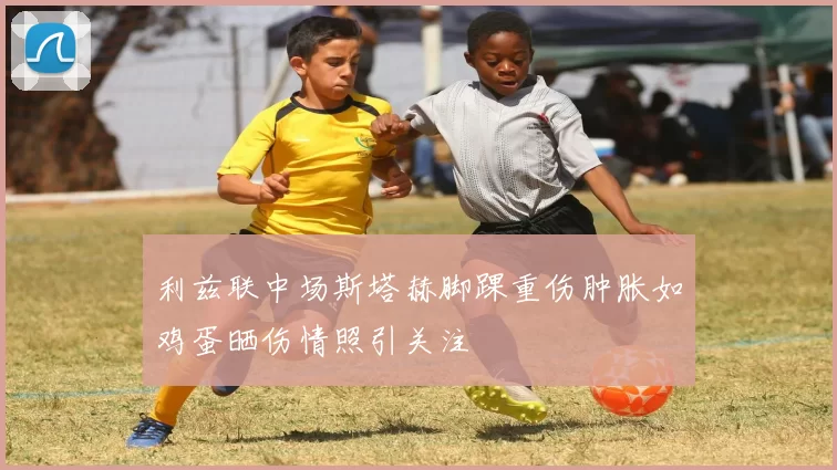 利兹联中场斯塔赫脚踝重伤肿胀如鸡蛋晒伤情照引关注